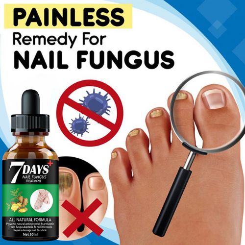 ALL NATURAL 7-Day Toenail Fungus Treatment